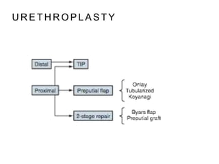 U R E T H R O P L A S T Y
 