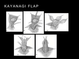 K A Y A N A G I F L A P
 