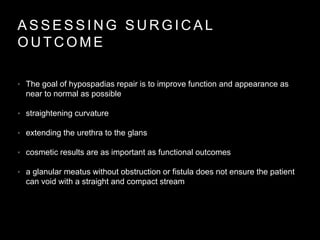 A S S E S S I N G S U R G I C A L
O U T C O M E
• The goal of hypospadias repair is to improve function and appearance as
near to normal as possible
• straightening curvature
• extending the urethra to the glans
• cosmetic results are as important as functional outcomes
• a glanular meatus without obstruction or fistula does not ensure the patient
can void with a straight and compact stream
 