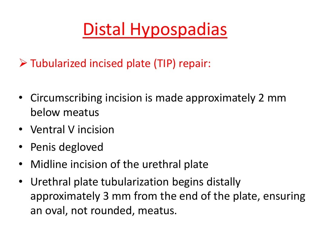 Hypospadias