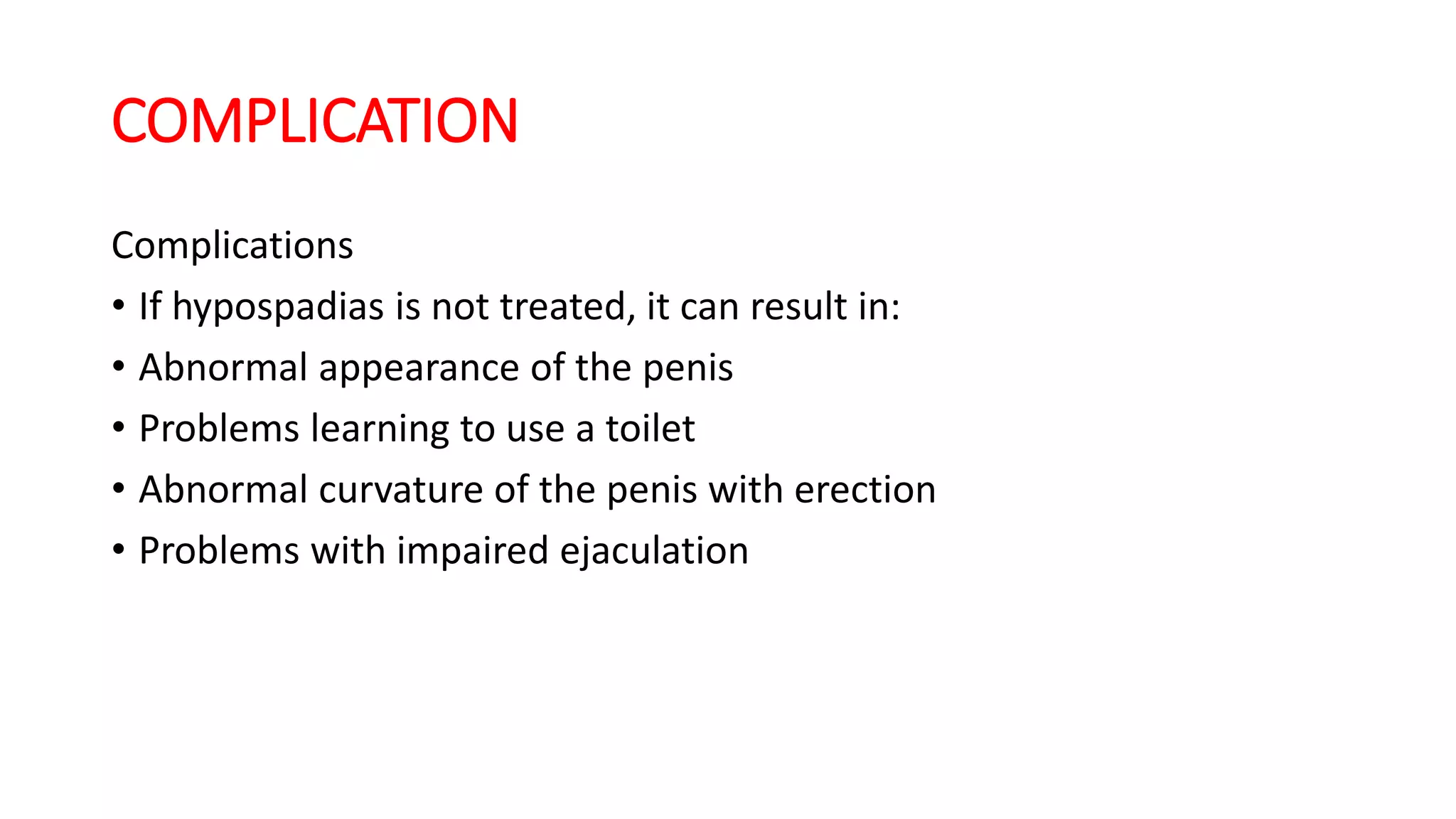 Hypospadias | PPTX