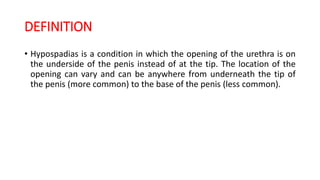 DEFINITION
• Hypospadias is a condition in which the opening of the urethra is on
the underside of the penis instead of at the tip. The location of the
opening can vary and can be anywhere from underneath the tip of
the penis (more common) to the base of the penis (less common).
 