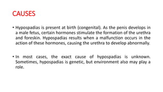 CAUSES
• Hypospadias is present at birth (congenital). As the penis develops in
a male fetus, certain hormones stimulate the formation of the urethra
and foreskin. Hypospadias results when a malfunction occurs in the
action of these hormones, causing the urethra to develop abnormally.
• In most cases, the exact cause of hypospadias is unknown.
Sometimes, hypospadias is genetic, but environment also may play a
role.
 