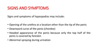 SIGNS AND SYMPTOMS
Signs and symptoms of hypospadias may include:
• Opening of the urethra at a location other than the tip of the penis
• Downward curve of the penis (chordee)
• Hooded appearance of the penis because only the top half of the
penis is covered by foreskin
• Abnormal spraying during urination
 