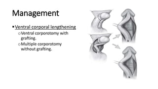 Management
Ventral corporal lengthening
oVentral corporotomy with
grafting.
oMultiple corporotomy
without grafting.
 