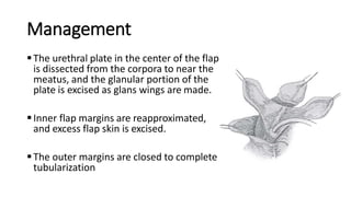 Management
The urethral plate in the center of the flap
is dissected from the corpora to near the
meatus, and the glanular portion of the
plate is excised as glans wings are made.
Inner flap margins are reapproximated,
and excess flap skin is excised.
The outer margins are closed to complete
tubularization
 