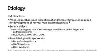 Etiology
 Multifactorial
 Proposed mechanism is disruption of androgenic stimulation required
for development of normal male external genitalia 1
 Genetic defects:
oMutation in genes that affect androgen metabolism, and estrogen and
androgen response
oHOXA4, IRX5, IRX6, EYA1, DGKK
 Associated genetic syndromes
oDenys-Drash syndrome
oWAGR syndrome
oOpitz syndrome
1 Choudhry S, Baskin LS, Lammer EJ, et al. Genetic polymorphisms in ESR1 and ESR2 genes, and risk of hypospadias in a multiethnic study population. J Urol. 2015;193(5):1625-31.
 