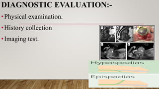 DIAGNOSTIC EVALUATION:-
•Physical examination.
•History collection
•Imaging test.
 