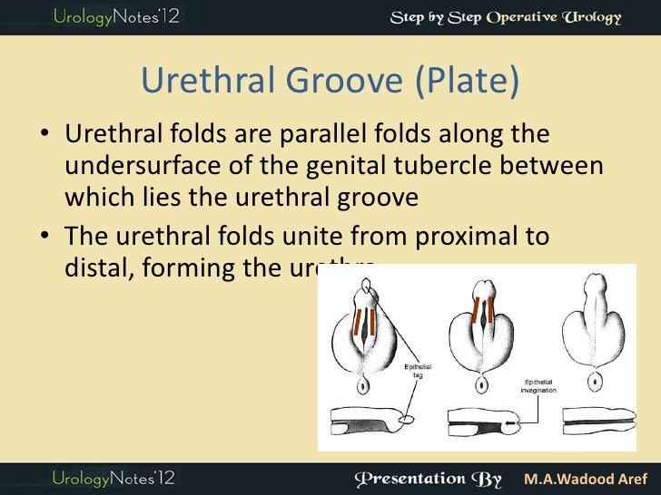 Hypospadias part 1 introd (step by step oper series)