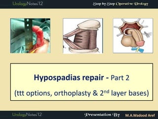 Hypospadias repair - Part 2
(ttt options, orthoplasty & 2nd layer bases)

                                    M.A.Wadood Aref
 