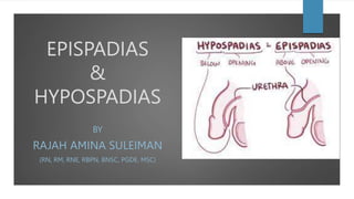 EPISPADIAS
&
HYPOSPADIAS
BY
RAJAH AMINA SULEIMAN
(RN, RM, RNE, RBPN, BNSC, PGDE, MSC)
 