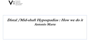 Distal /Mid-shaft Hypospadias : How we do it
Antonio Marte
 