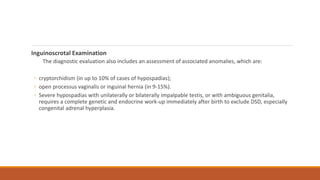 Inguinoscrotal Examination
The diagnostic evaluation also includes an assessment of associated anomalies, which are:
◦ cryptorchidism (in up to 10% of cases of hypospadias);
◦ open processus vaginalis or inguinal hernia (in 9-15%).
◦ Severe hypospadias with unilaterally or bilaterally impalpable testis, or with ambiguous genitalia,
requires a complete genetic and endocrine work-up immediately after birth to exclude DSD, especially
congenital adrenal hyperplasia.
 