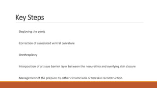 Key Steps
Degloving the penis
Correction of associated ventral curvature
Urethroplasty
Interposition of a tissue barrier layer between the neourethra and overlying skin closure
Management of the prepuce by either circumcision or foreskin reconstruction.
 