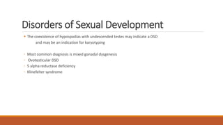 Disorders of Sexual Development
 The coexistence of hypospadias with undescended testes may indicate a DSD
and may be an indication for karyotyping
◦ Most common diagnosis is mixed gonadal dysgenesis
◦ Ovotesticular DSD
◦ 5 alpha reductase deficiency
◦ Klinefelter syndrome
 