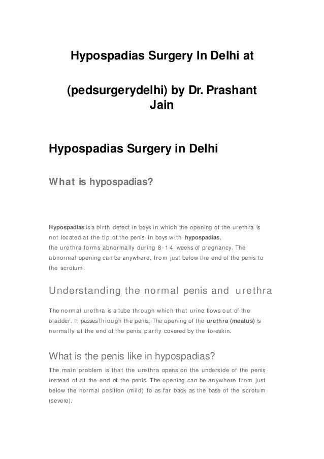 Hypospadias Surgery In Delhi at
(pedsurgerydelhi) by Dr. Prashant
Jain
Hypospadias Surgery in Delhi
What is hypospadias?
Hypospadias is a birth defect in boys in which the opening of the urethra is
not located at the tip of the penis. In boys with hypospadias,
the urethra forms abnormally during 8 - 1 4 weeks of pregnancy. The
abnormal opening can be anywhere, from just below the end of the penis to
the scrotum.
Understanding the normal penis and urethra
The normal urethra is a tube through which that urine flows out of the
bladder. It passes through the penis. The opening of the urethra (meatus) is
normally at the end of the penis, partly covered by the foreskin.
What is the penis like in hypospadias?
The main problem is that the urethra opens on the underside of the penis
instead of at the end of the penis. The opening can be anywhere from just
below the normal position (mild) to as far back as the base of the scrotum
(severe).
 
