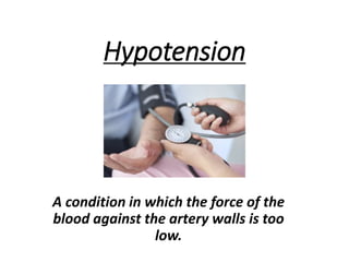 Hypotension
A condition in which the force of the
blood against the artery walls is too
low.
 