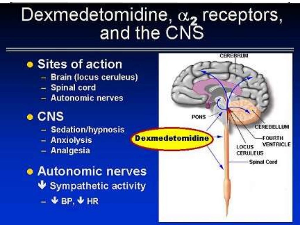 Hypotensive anesthesia
