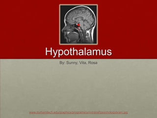 Hypothalamus By: Sunny, Vita, Rosa www.durhamtech.edu/graphics/programs/univtransf/psychologybrain.jpg 