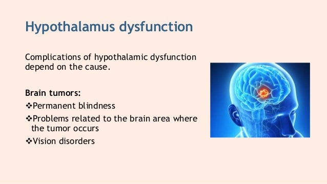hypothalamus