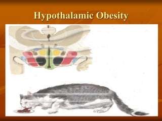 Hypothalamic Obesity
 