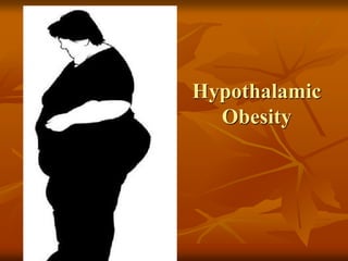 Hypothalamic
Obesity
 
