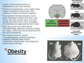 * Lesions: Ventromedial portion of
hypothalamus may cause obesity.
* Patients are hyperphagic until a higher body
weight is reached at which point they
maintain it (unless the lesions progress).
* These patients feeding behaviors mimic
obese individuals without HT lesions: less
active, eat more at each meal, eat more
quickly and when food is more accessible,
are emotional and appeased by food intake.
* MOA: may result from affecting the
catcholaminergic pathways coursing through
the region, rather than actual destruction of
the nuclei themselves.
* Most frequent lesions: include
craniopharyngioma, pituitary adenoma,
surgeries removing these tumors,
encephalitis. Occasionally, may respond to
anticonvulsant therapy.
*Obesity
 