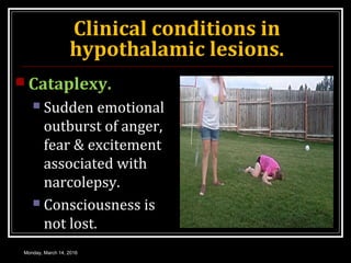 Clinical conditions in
hypothalamic lesions.
 Cataplexy.
 Sudden emotional
outburst of anger,
fear & excitement
associated with
narcolepsy.
 Consciousness is
not lost.
Monday, March 14, 2016
 