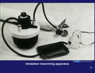 Inhalation rewarming apparatus
Source undetermined
31
 