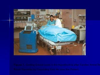 Figure 1. Cooling Device Used in the Hypothermia after Cardiac Arrest Stu
W hich Operates by Circulating Cool Air over the Patient.
 