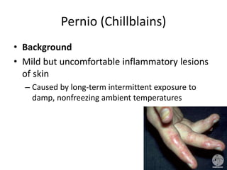 Pernio (Chillblains)
• Background
• Mild but uncomfortable inflammatory lesions
of skin
– Caused by long-term intermittent exposure to
damp, nonfreezing ambient temperatures
 