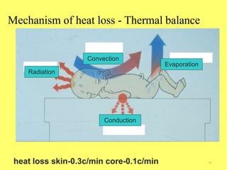 heat loss skin-0.3c/min core-0.1c/min
Mechanism of heat loss - Thermal balance
14
Conduction
Radiation
Convection
Evaporation
 