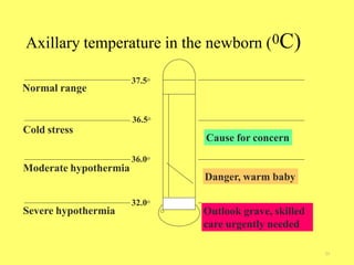 Normal range
Axillary temperature in the newborn (0C)
21
Cold stress
Moderate hypothermia
Severe hypothermia Outlook grave, skilled
care urgently needed
Danger, warm baby
Cause for concern
37.5o
36.5o
36.0o
32.0o
 
