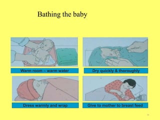 Bathing the baby
38
Warm room – warm water Dry quickly & thoroughly
Dress warmly and wrap Give to mother to breast feed
 