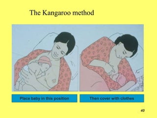 The Kangaroo method
Place baby in this position
40
Then cover with clothes
 