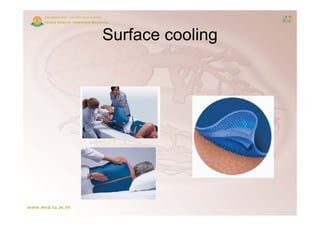 Surface cooling
 