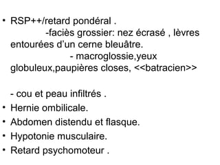 • RSP++/retard pondéral .
          -faciès grossier: nez écrasé , lèvres
  entourées d’un cerne bleuâtre.
                - macroglossie,yeux
  globuleux,paupières closes, <<batracien>>

    - cou et peau infiltrés .
•   Hernie ombilicale.
•   Abdomen distendu et flasque.
•   Hypotonie musculaire.
•   Retard psychomoteur .
 