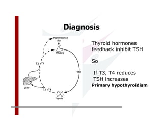 Diagnosis

       Thyroid hormones
       feedback inhibit TSH

       So

       If T3, T4 reduces
       TSH increases
       Primary hypothyroidism
 
