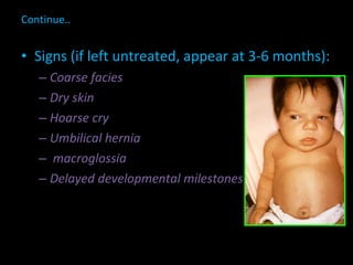 Continue.. Signs (if left untreated, appear at 3-6 months): Coarse facies Dry skin Hoarse cry Umbilical hernia  macroglossia Delayed developmental milestones 