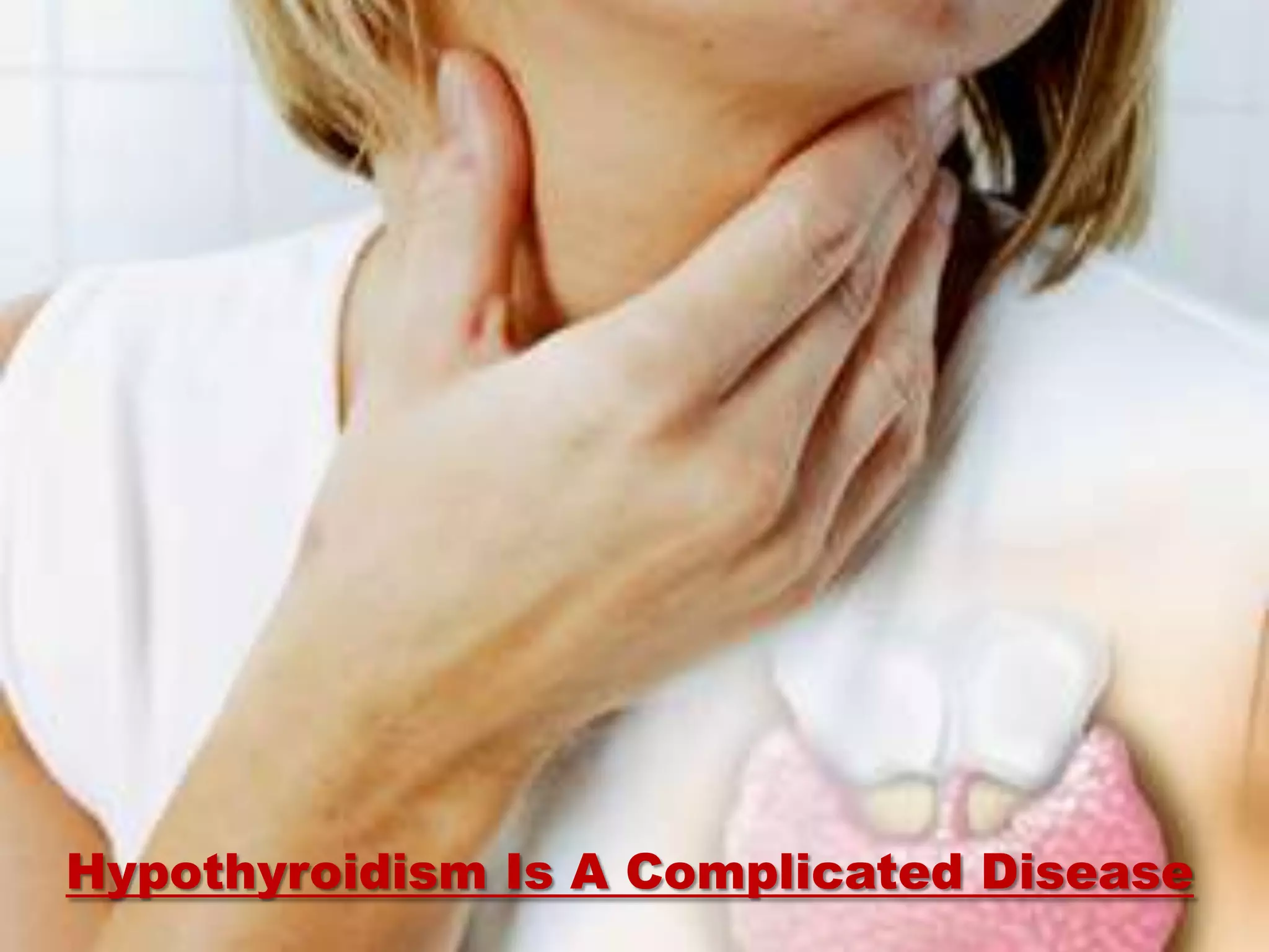 Hypothyroidism PPT