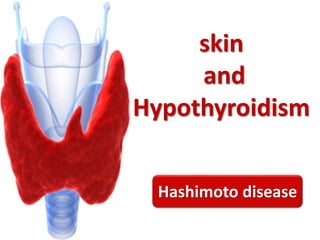 skin
and
Hypothyroidism
Hashimoto disease
 