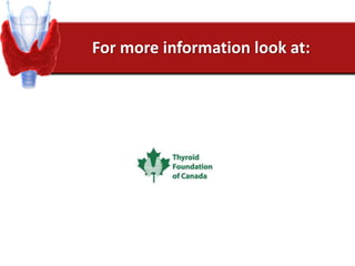 For more information look at:
 