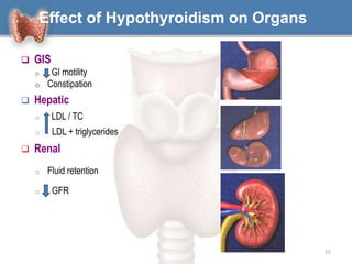 Effect of Hypothyroidism on Organs
 GIS
o GI motility
o Constipation
 Hepatic
o LDL / TC
o LDL + triglycerides
 Renal
o Fluid retention
o GFR
15
 