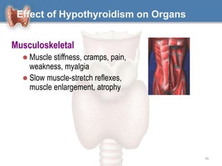 16
Effect of Hypothyroidism on Organs
Musculoskeletal
 Muscle stiffness, cramps, pain,
weakness, myalgia
 Slow muscle-stretch reflexes,
muscle enlargement, atrophy
 