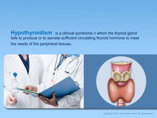 Hypothyroidism is a clinical syndrome n which the thyroid gland
fails to produce or to secrete sufficient circulating thyroid hormone to meet
the needs of the peripheral tissues.
Copyright © 2011 Abbott India Limited. All rights reserved
 