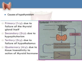  Causes of hypothyroidism
5
 