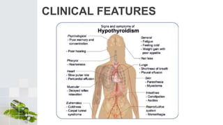 CLINICAL FEATURES
 