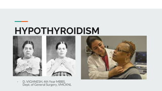 HYPOTHYROIDISM
- D. VIGHNESH, 4th Year MBBS,
Dept. of General Surgery, VMCKNL
 