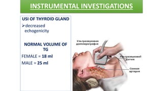 INSTRUMENTAL INVESTIGATIONS
USI OF THYROID GLAND
decreased
echogenicity
NORMAL VOLUME OF
TG
FEMALE = 18 ml
MALE = 25 ml
 