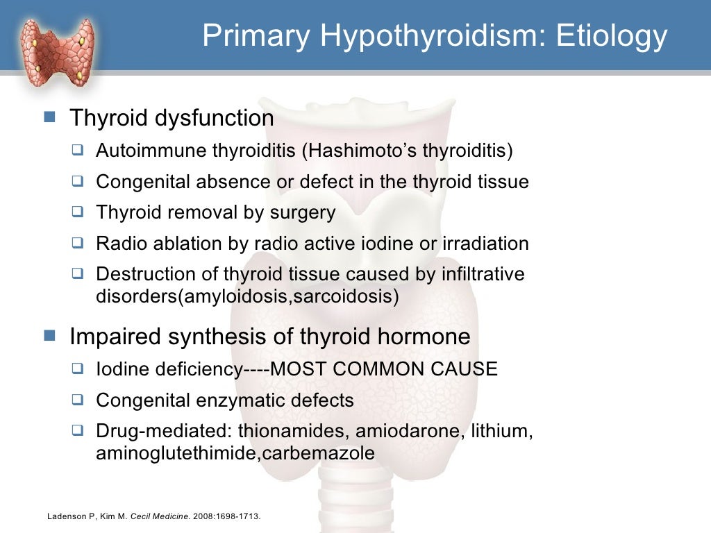 clinical case study hypothyroidism